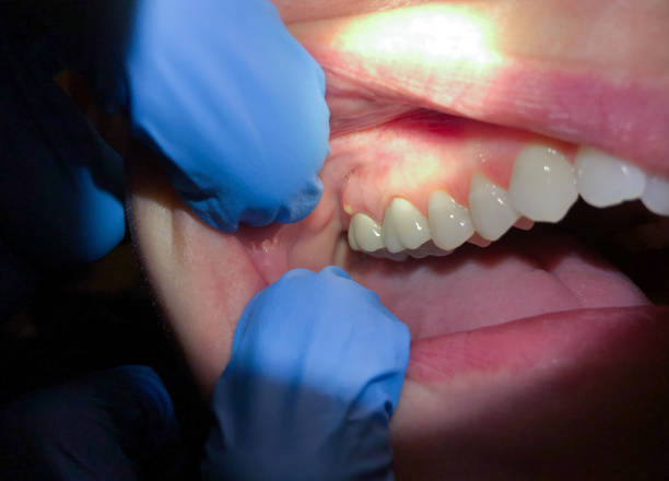 Best Emergency Dental Services for Seniors in Norco, LA